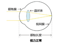 Vol.6 近视?远视?散光?老花