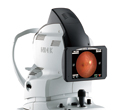 Fundus Cameras