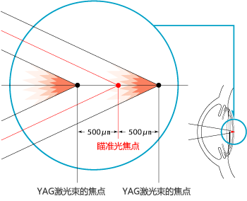 Focus shift with wide range